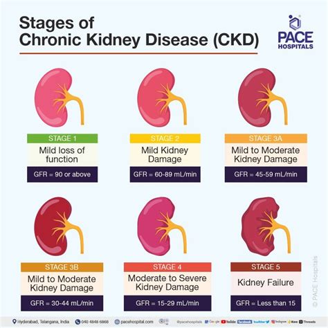 chronic kidney disease near occidental|Prevalence of chronic kidney disease stages 3–5 in low.